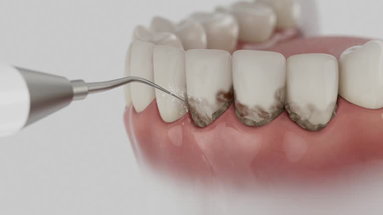 Reliable Dental contractor in Three Forks, MT by Smile Center Dentistry